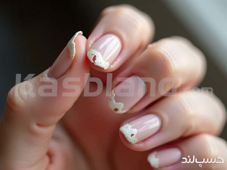 نیاز به ترمیم و نگهداری ناخن
