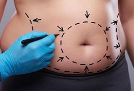 نمایش توضیحات تخلیه چربی شکم پهلو