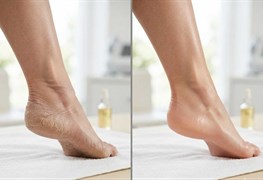 نمایش توضیحات خدمات کفسابی و ارتونیل و دوره ی آموزشی آن