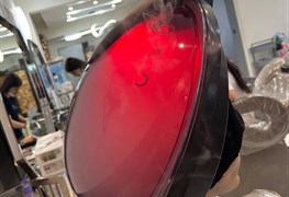 نمایش توضیحات مزوتراپی مو