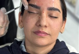 نمایش توضیحات تزریق بوتاکس