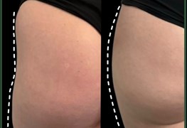 نمایش توضیحات فیلر بادی