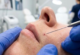 نمایش توضیحات الکترولیز