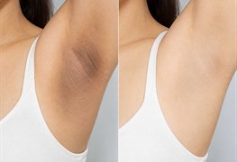 نمایش توضیحات روشن سازی نواحی تیره
