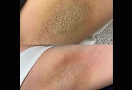 نمایش توضیحات روشن سازی پوست