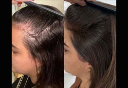 نمایش توضیحات اسکالپ