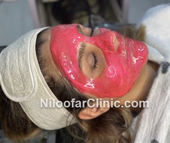 نمونه هایی از فیشیال صورت