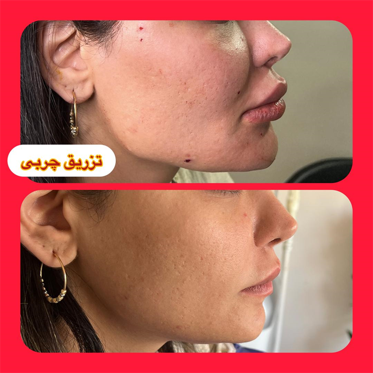 نمونه زاویه سازی فک